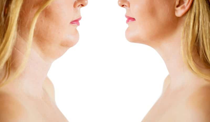 two blonde women in profile, one with double chin and one without
