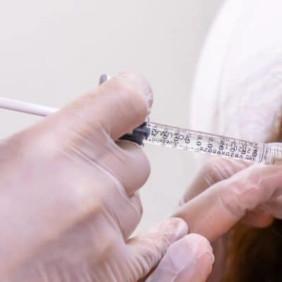 injectable skin treatment on woman's face
